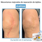 Crema antiinflamatoria multisíntomas con veneno de abeja (OFERTA 2X1)®